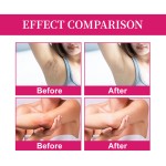 Private Areas Cream Manufacturer - Best Skin Whitening Safe Gentle