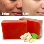 Toilet Soap Supplier - Manufacturing Anti Acne Dark Spots