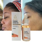 Ginger Essential Oil Supplier - 30ml Firming Skin Rejuvenates