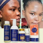 Whitening Skin Care Supplier - OEM Strong Whitening Moisturizing