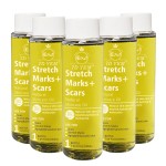 Stretch Marks Oil Supplier - Natural Ingredients Body Peeling