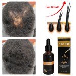 Hair Growth Oil Factory - OEM Smoothing Repairing Scalp