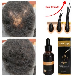 Hair Growth Oil Factory - OEM Smoothing Repairing Scalp