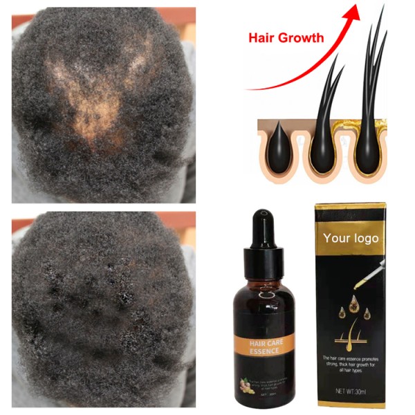 Hair Growth Oil Factory - OEM Smoothing Repairing Scalp