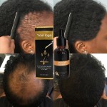 Hair Growth Oil Factory - OEM Smoothing Repairing Scalp