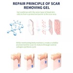 Scar Gel Manufacturer - Custom Advanced 100% Silicone Scar Removal Gel