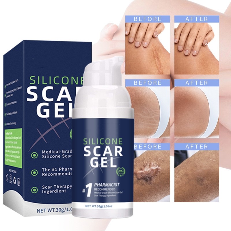 Scar Gel Manufacturer - Custom Advanced 100% Silicone Scar Removal Gel