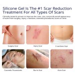 Scar Gel Manufacturer - Custom Advanced 100% Silicone Scar Removal Gel
