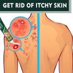 Anti-itch Ointment Manufacturer - South Moon Herbal Extract Psoriasis Cream