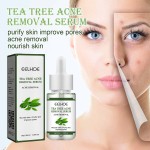 Facial Serum Supplier - 30 ml Herbal Plant Anti Wrinkle Acne Remover Serum