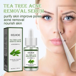 Facial Serum Supplier - 30 ml Herbal Plant Anti Wrinkle Acne Remover Serum