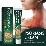 Anti-itch Ointment Manufacturer - South Moon Herbal Extract Psoriasis Cream