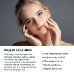 Facial Serum Supplier - 30 ml Herbal Plant Anti Wrinkle Acne Remover Serum