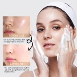 Facial Cleanser Supplier - Flower Cleanser Mousse Exfoliating Removing Blackheads