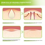 Pore Patches Supplier - Deep Cleaning Healing Blemish Blackhead Hydrocolloid