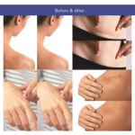 Silicone Patches Manufacturer - Private Label Silicone Belly Eye Patches Reusable