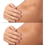 Silicone Patches Manufacturer - Private Label Silicone Belly Eye Patches Reusable