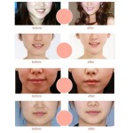 Face Slimming Patch Factory - Korea Double Line Band Chin Lifting V Shape