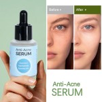 Vitamin C Serum Supplier - Wholesale Vitamin C Face Oil Turmeric Skin Care