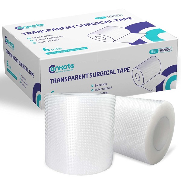 Micropore Tape Manufacturer - Antistatic Medical Fixing OEM