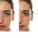 Elastic Adhesive Bandage Manufacturer - Breathable Athletic Cotton