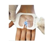 Self-adhesive Wound Dressing Manufacturer - Sterile PU Transparent