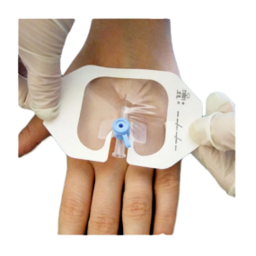 PU Film Wound Dressing Manufacturer - Waterproof IV Site Management