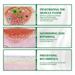 Acne Cream Factory - Anti Acne Follicles Clean