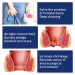 Hemorrhoid Cream Supplier - Anus Repair Cream Mixed Formula