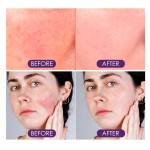 Skin Care Essence Manufacturer - Moisturizing Softening Wholesale