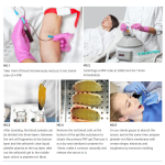 CGF Tube Factory - 10ml PET A-PRF Dental Hair Loss