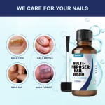 Nail Repair Liquid Supplier - Herbal Fungus Treatment