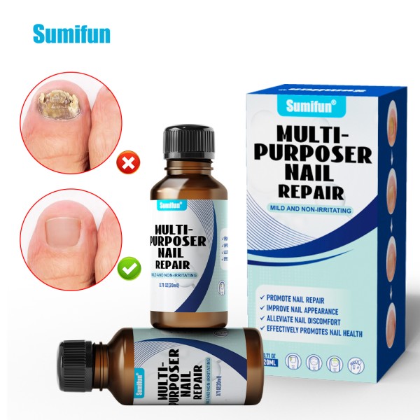 Nail Repair Liquid Supplier - Herbal Fungus Treatment