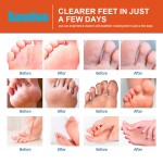 Anti-Fungal Spray Manufacturer - Herbal Deodorant Powder