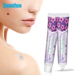 Skin Tag Removal Kit Supplier - Safe Tools Ointment Private Label