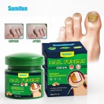 Nail Fungus Cream Supplier - Foot Fungal Treatment