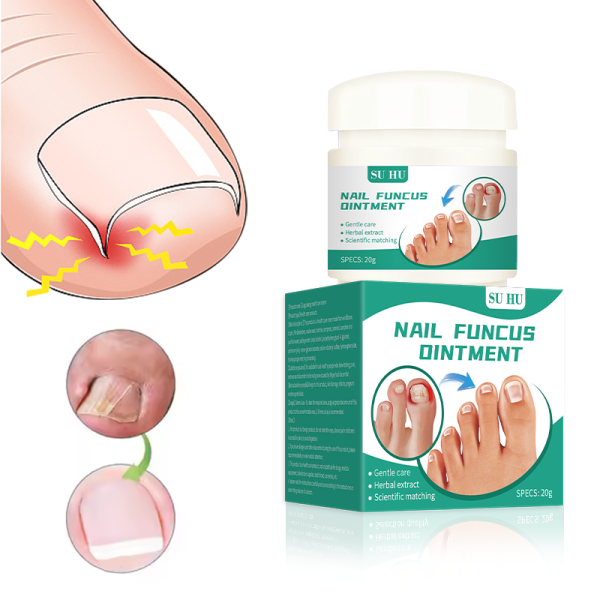 Fungal Care Cream Manufacturer - Paronychia Toe Infection