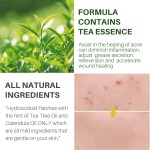 Hydrocolloid Acne Patch Factory - Invisible Korean Custom