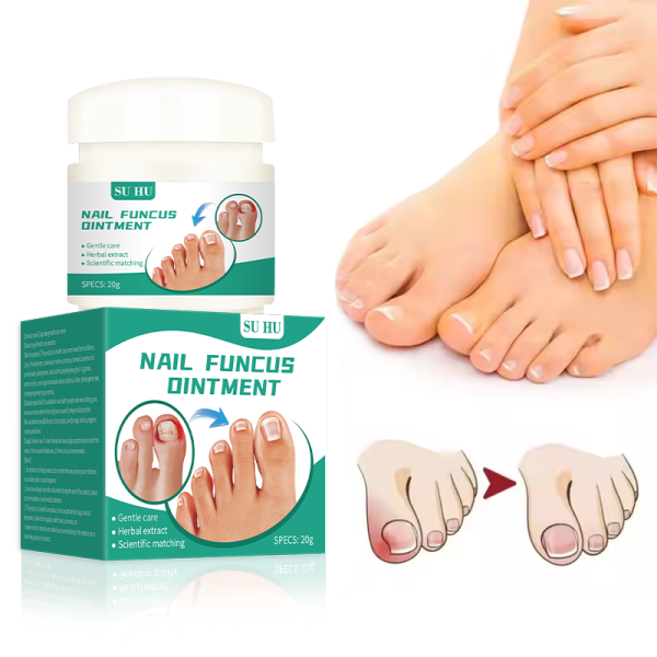 Onychomycosis Ointment Factory - Nail Groove Itching Care