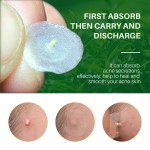 Acne Free Patch Supplier - 72 Pieces Facial Skin Care