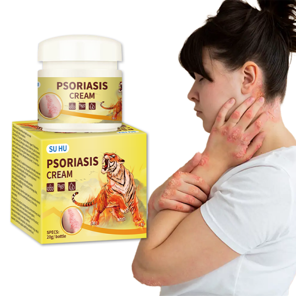 Skin Tinea Cream Supplier - Neck Back Hand Joint Itch