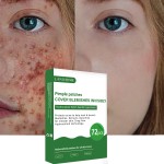 Acne Free Patch Supplier - 72 Pieces Facial Skin Care