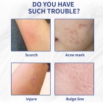 Nail Antibacterial Cream Manufacturer - 20g Fungal Care