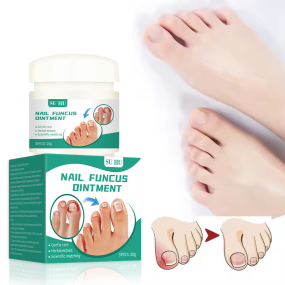 Nail Fungus Cream Supplier - Toe Nail Gel Health Care