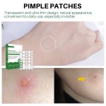 Hydrocolloid Acne Patch Factory - Invisible Korean Custom