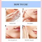 Acne Healing Patch Manufacturer - Pimple Blemish Whitehead