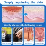 Herbal Hemorrhoid Cream Supplier - Anal Fissure Pain Relief