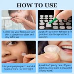 Hydrocolloid Acne Patch Factory - Transparent Pimple Treatment