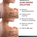 Silicone Scar Patch Supplier - Waterproof Burn Hyperplasia