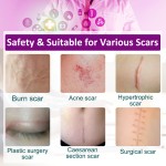 Silicone Scar Sheets Factory - Facial Belly Leg Removal